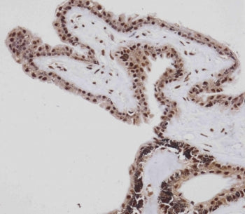 Retinoblastoma Antibody / Rb1