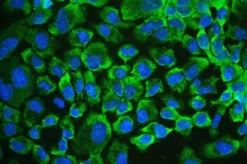 Immunofluorescent staining of FFPE human A431 cells with UPF1 antibody (green) and DAPI nuclear stai