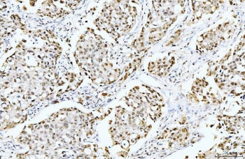 Cyclophilin E Antibody / PPIE