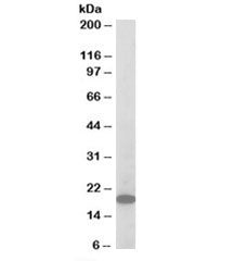 Western blot testing of mouse brain lysate with ARPC3 antibody at 1ug/ml. Predicted molecular weight