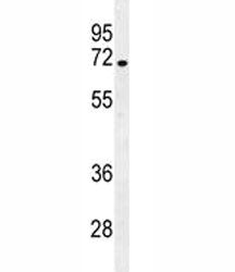 NUMB Antibody