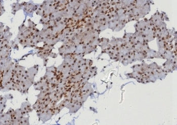 MGMT Antibody