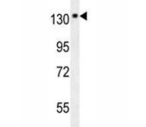 NTRK1 Antibody