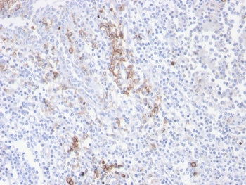 IHC staining of FFPE human tonsil with recombinant CD38 antibody. HIER: boil tissue sections in pH 9