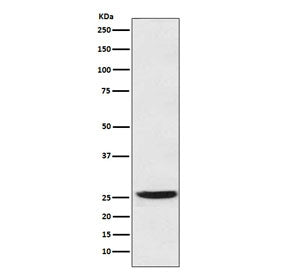 HPGD Antibody / 15-PGDH