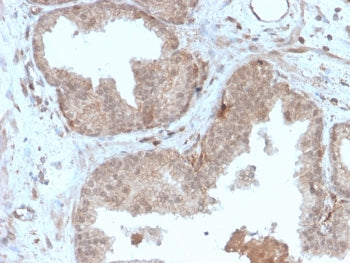 IHC staining of FFPE human prostate tissue with recombinant MVP antibody (clone r1032). HIER: boil t