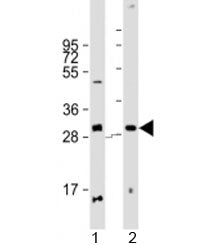 Western blot testing of human 1) pancreas and 2) placenta lysate with PPP1R3E antibody at 1:2000. Pr