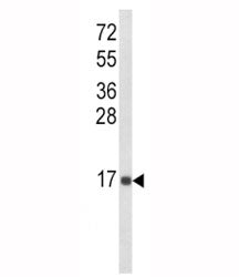 Western blot analysis of IL-8 antibody and MDA-MB468 lysate. Predicted molecular weight: ~8 kDa (mon