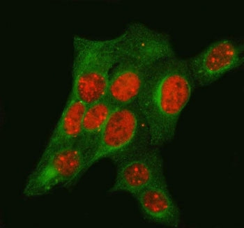 TP53BP1 Antibody / TP53-binding protein 1