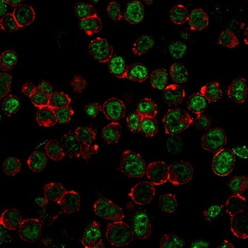 Immunofluorescent staining of permeabilized human HEK293 cells with Neurofilament antibody cocktail 