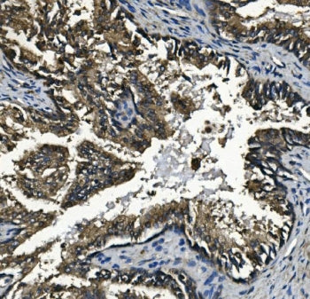 GAA Antibody / Glucosidase alpha acid