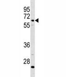 C8B Antibody