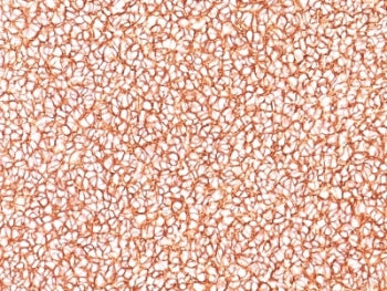 CD99 Antibody
