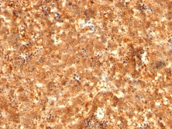 IHC: Formalin-fixed, paraffin-embedded human fetal liver stained with AFP antibody (C2 + C3 + MBS-12