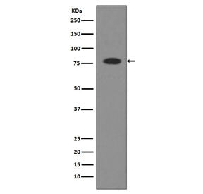 Transferrin Antibody