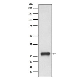 HLA-DPB1 Antibody (MHC II)