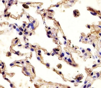 MMP12 Antibody