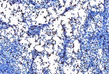 PU.1 Antibody / SPI1
