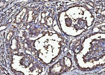MARK3 Antibody / MAP/microtubule affinity-regulating kinase 3