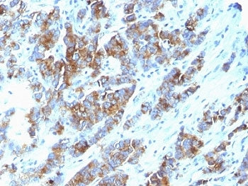 MUC1 Antibody / Mucin-1
