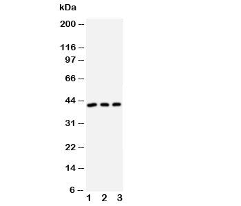 DAPK2 Antibody
