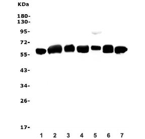 Calreticulin Antibody / CALR