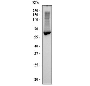 CES1 Antibody / Carboxylesterase 1