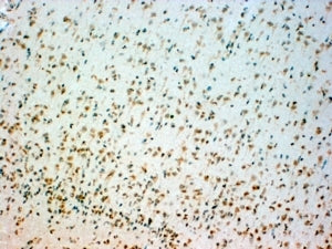 IHC testing of FFPE human brain stem with TPH2 antibody at 4ug/ml. HIER: steamed with pH6 citrate bu