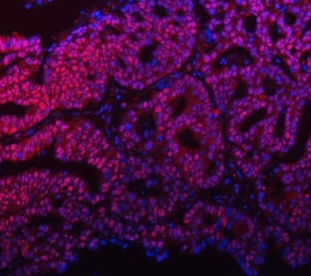 mSin3A Antibody / SIN3A