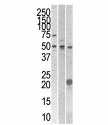 STYK1 Antibody