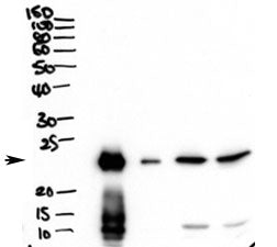 Western blot testing of secretions from human primary airway cells in culture (lanes 1 and 2) and in