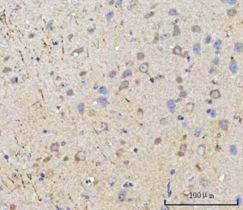 PPWD1 Antibody / Peptidylprolyl isomerase domain and WD repeat-containing protein 1