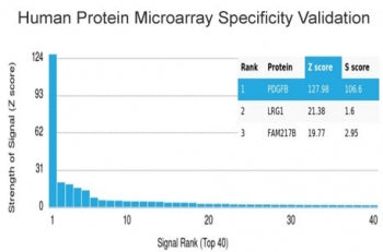 PDGF beta Antibody