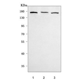 mGluR5 Antibody / Glutamate Metabotropic Receptor 5 / GRM5