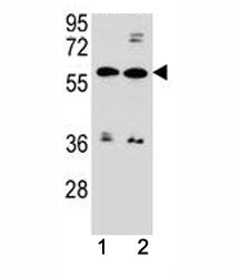 ABCG4 Antibody