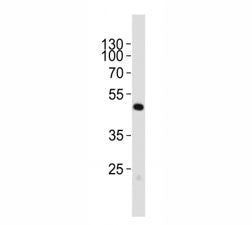 Western blot analysis of lysate from mouse cerebellum tissue lysate using Pax6 antibody; Ab was dilu