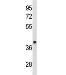 ACAA1 Antibody