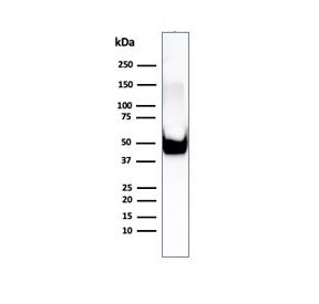 Western blot testing of human U-87 MG cell lysate using Vimentin antibody (clone rVIM/6575). Predict