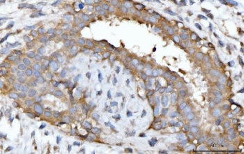 GNB3 Antibody