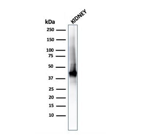 AMACR / p504S Antibody (Prostate Cancer Marker)