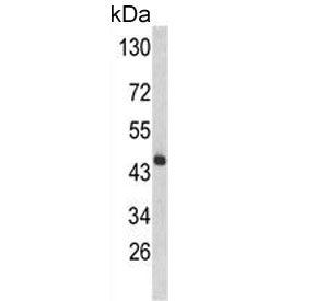 4-hydroxyphenylpyruvate dioxygenase Antibody / 4HPPD / HPD