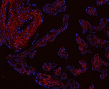 Immunofluorescent staining of FFPE human placental tissue with Collagen I antibody (red) and DAPI nu