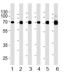 Acetylcholinesterase antibody western blot analysis in 1) human Raji, 2) human Jurkat, 3) human COS7
