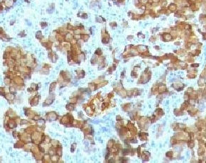 MART-1 / Melan-A Antibody