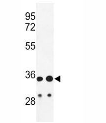 IGH Antibody