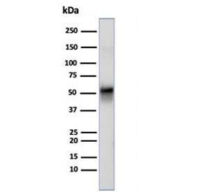 Western blot testing of human U-87 MG cell lysate using recombinant VIM antibody (clone rVIM/6914). 
