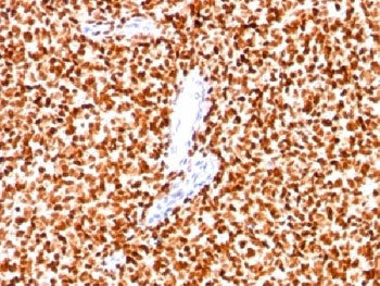 NKX2.2 Antibody