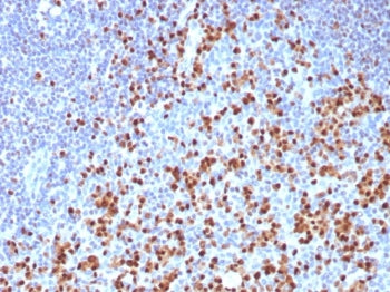 IHC staining of FFPE human tonsil tissue with IRF4 antibody (clone MUM1/8274R). HIER: boil tissue se