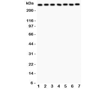 LRRK2 Antibody