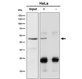 Immunoprecipitation of RBMXL2 protein from 500ug of human HeLa whole cell lysate using RBMXL2 antibo